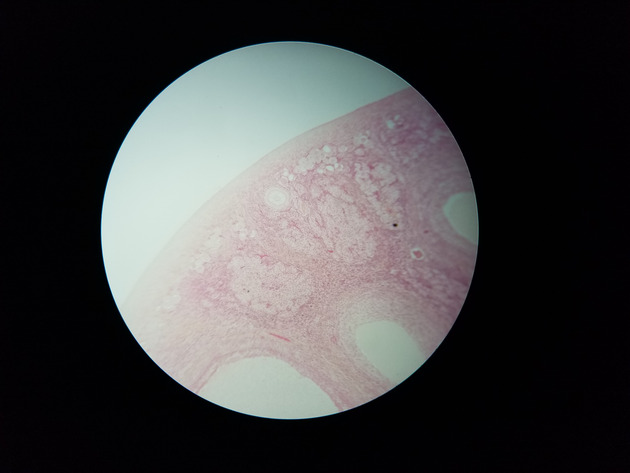 Ovary Slides - Ovary 004 100X
